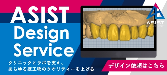 ASIST Design Service